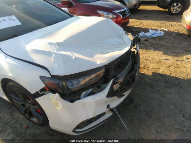 Photo 5 VIN: 19UUB2F69JA000935 - ACURA TLX 