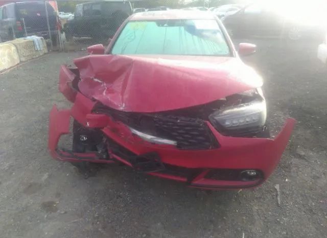 Photo 5 VIN: 19UUB2F6XJA000684 - ACURA TLX 