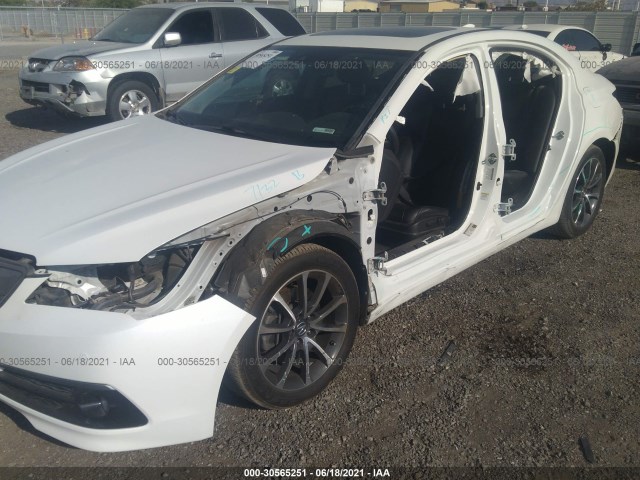 Photo 5 VIN: 19UUB2F72FA016250 - ACURA TLX 