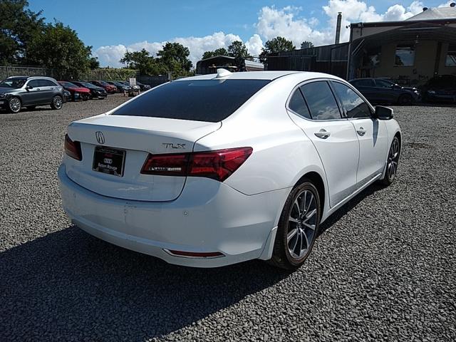 Photo 3 VIN: 19UUB2F75HA001809 - ACURA TLX ADVANC 