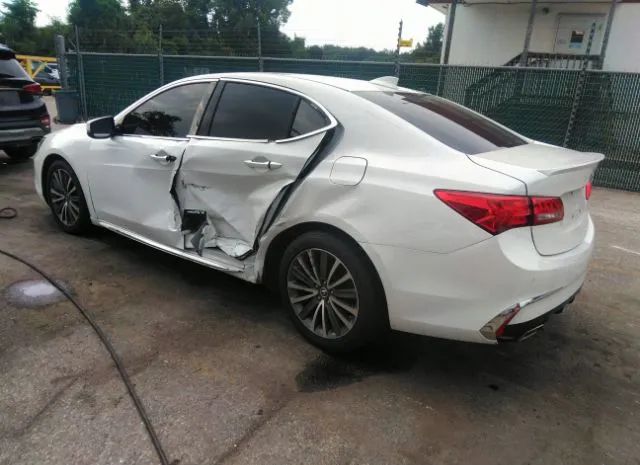 Photo 2 VIN: 19UUB2F75JA000794 - ACURA TLX 