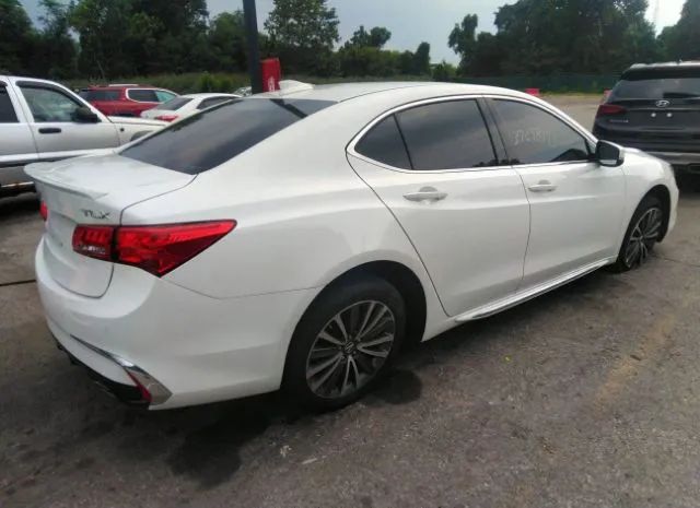 Photo 3 VIN: 19UUB2F75JA000794 - ACURA TLX 