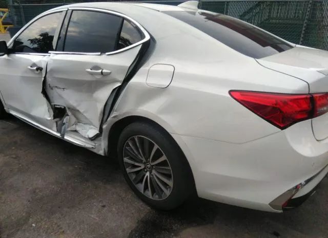 Photo 5 VIN: 19UUB2F75JA000794 - ACURA TLX 