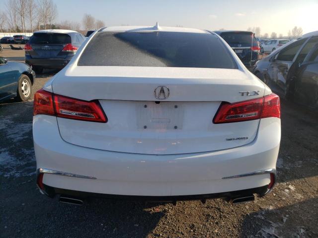 Photo 5 VIN: 19UUB3F38JA801500 - ACURA TLX 