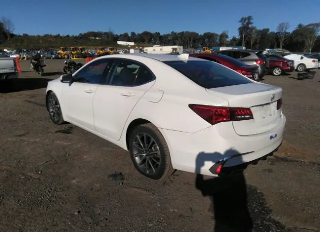 Photo 2 VIN: 19UUB3F39JA004396 - ACURA TLX 