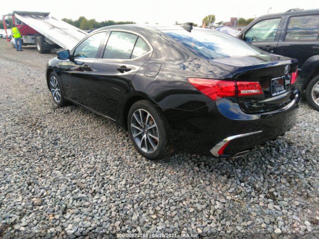 Photo 2 VIN: 19UUB3F39KA006165 - ACURA TLX 