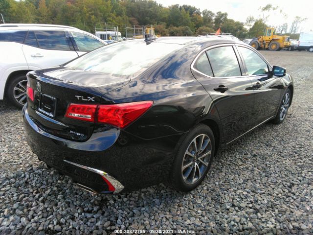 Photo 3 VIN: 19UUB3F39KA006165 - ACURA TLX 