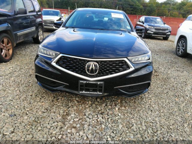 Photo 5 VIN: 19UUB3F39KA006165 - ACURA TLX 