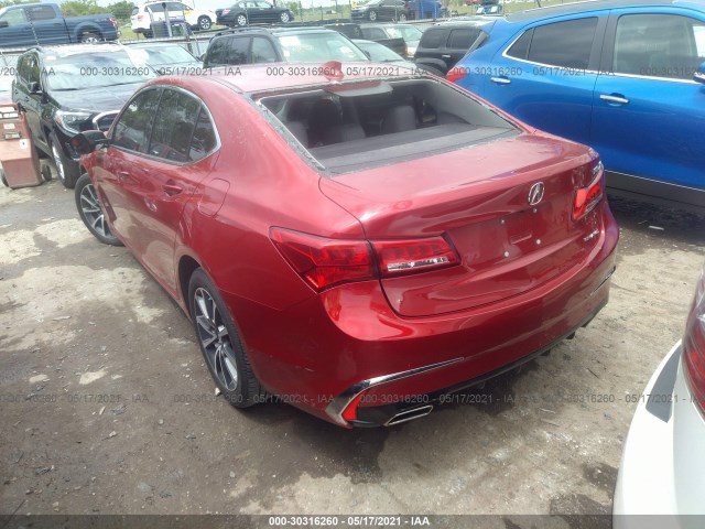 Photo 2 VIN: 19UUB3F39LA001338 - ACURA TLX 