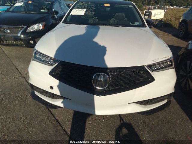 Photo 5 VIN: 19UUB3F42LA004042 - ACURA TLX 