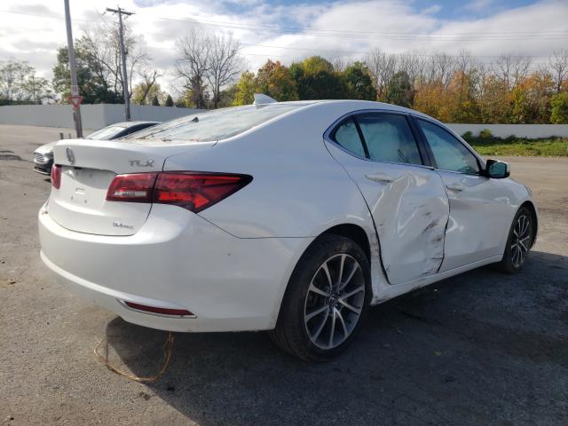 Photo 3 VIN: 19UUB3F50GA004118 - ACURA TLX TECH 