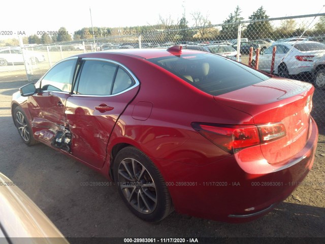 Photo 2 VIN: 19UUB3F50HA001981 - ACURA TLX 