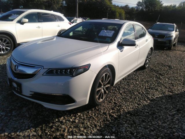 Photo 1 VIN: 19UUB3F52HA000704 - ACURA TLX 