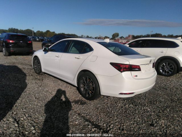 Photo 2 VIN: 19UUB3F52HA000704 - ACURA TLX 