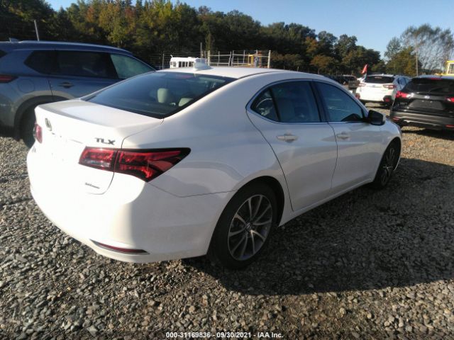 Photo 3 VIN: 19UUB3F52HA000704 - ACURA TLX 