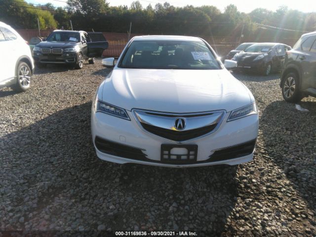 Photo 5 VIN: 19UUB3F52HA000704 - ACURA TLX 