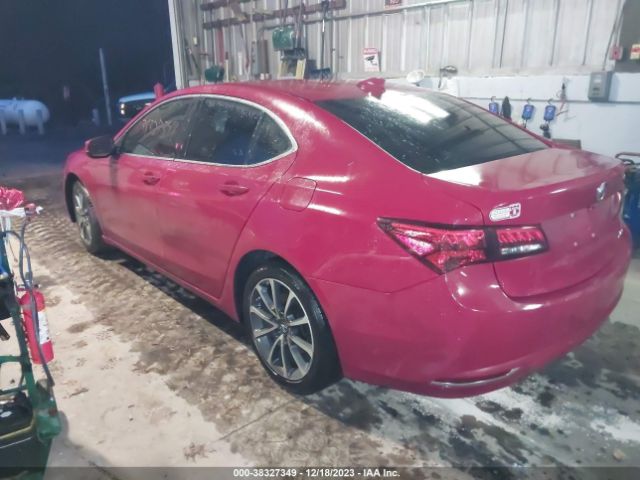 Photo 2 VIN: 19UUB3F54HA000638 - ACURA TLX 