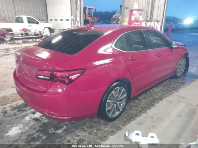 Photo 3 VIN: 19UUB3F54HA000638 - ACURA TLX 