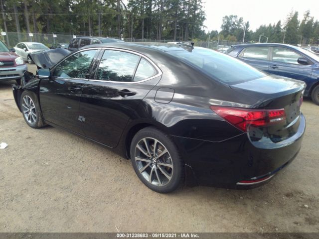 Photo 2 VIN: 19UUB3F55HA003189 - ACURA TLX 