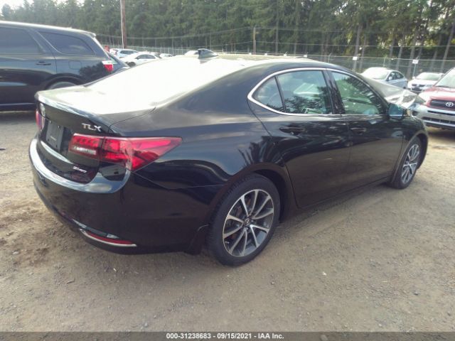 Photo 3 VIN: 19UUB3F55HA003189 - ACURA TLX 