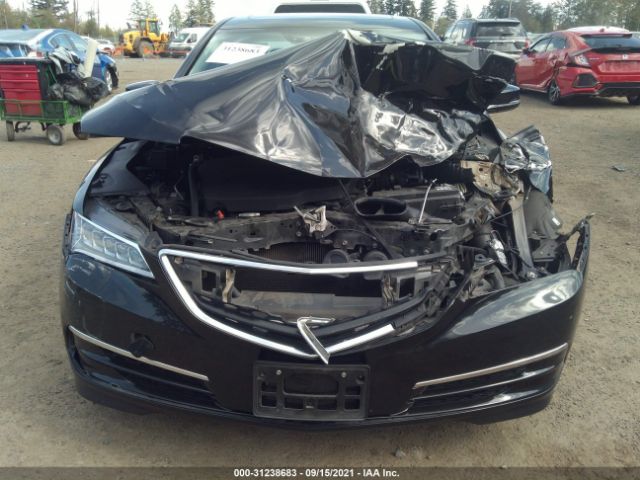 Photo 5 VIN: 19UUB3F55HA003189 - ACURA TLX 