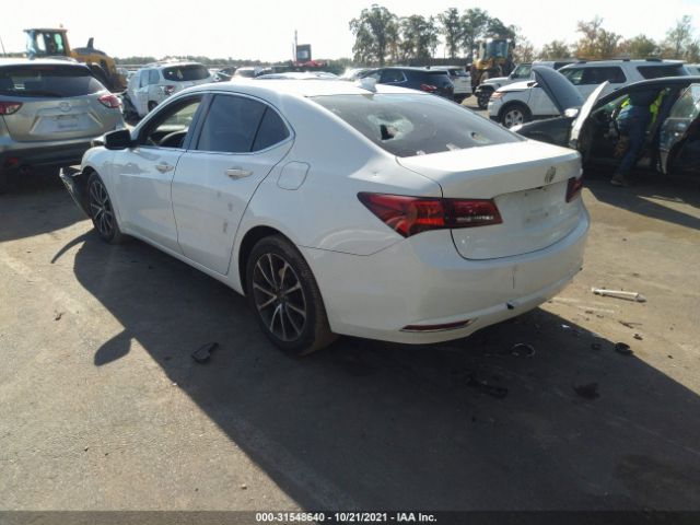 Photo 2 VIN: 19UUB3F56FA007426 - ACURA TLX 