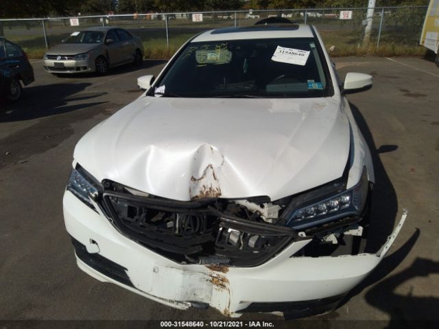 Photo 5 VIN: 19UUB3F56FA007426 - ACURA TLX 