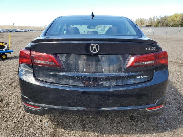 Photo 5 VIN: 19UUB3F56HA800051 - ACURA TLX 