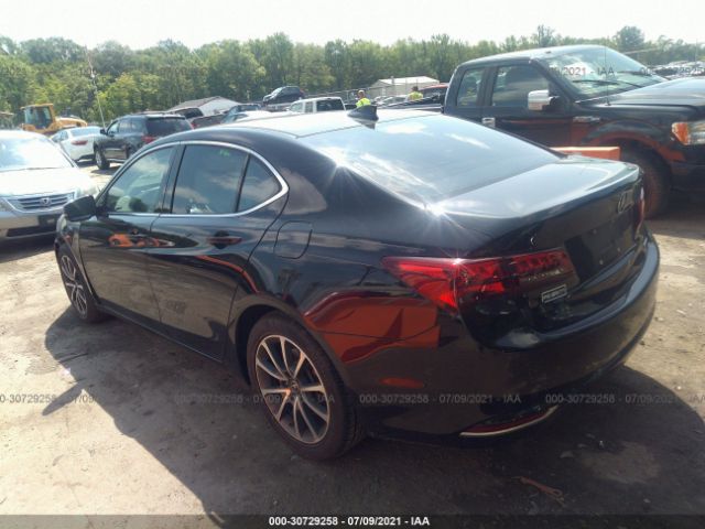 Photo 2 VIN: 19UUB3F57HA002481 - ACURA TLX 