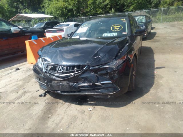 Photo 5 VIN: 19UUB3F57HA002481 - ACURA TLX 