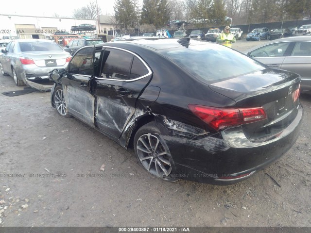 Photo 2 VIN: 19UUB3F57HA002576 - ACURA TLX 