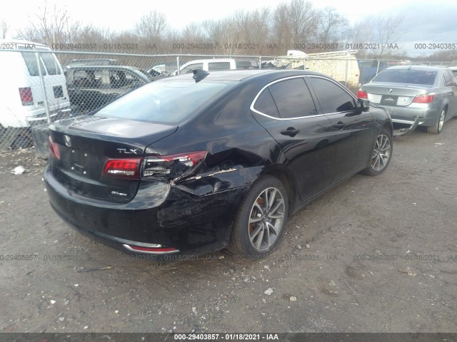 Photo 3 VIN: 19UUB3F57HA002576 - ACURA TLX 