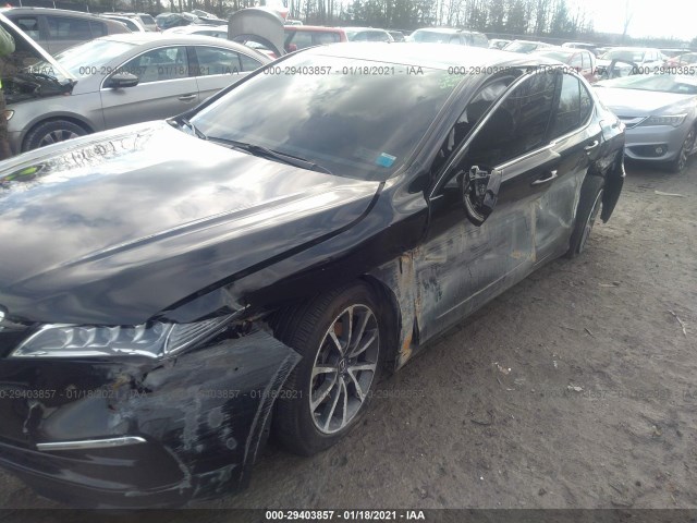 Photo 5 VIN: 19UUB3F57HA002576 - ACURA TLX 