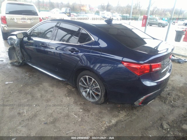 Photo 2 VIN: 19UUB3F58JA001572 - ACURA TLX 