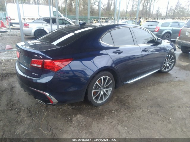 Photo 3 VIN: 19UUB3F58JA001572 - ACURA TLX 