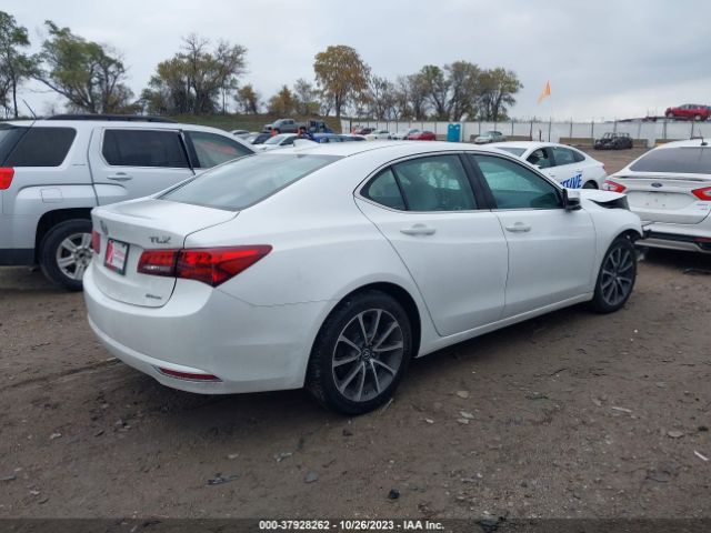 Photo 3 VIN: 19UUB3F59GA004263 - ACURA TLX 