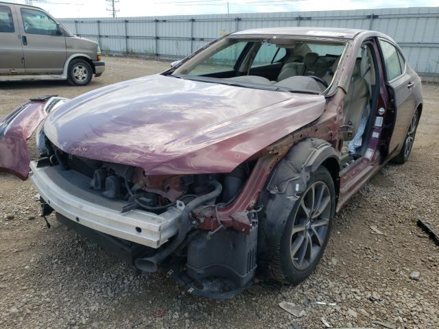 Photo 1 VIN: 19UUB3F5XFA009907 - ACURA TLX TECH 