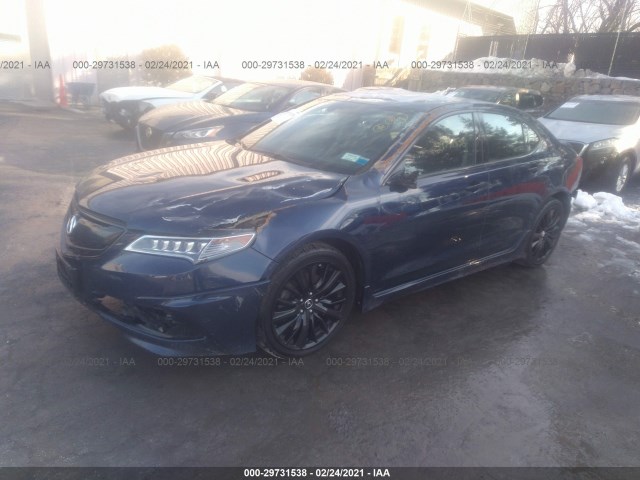 Photo 1 VIN: 19UUB3F5XHA001180 - ACURA TLX 