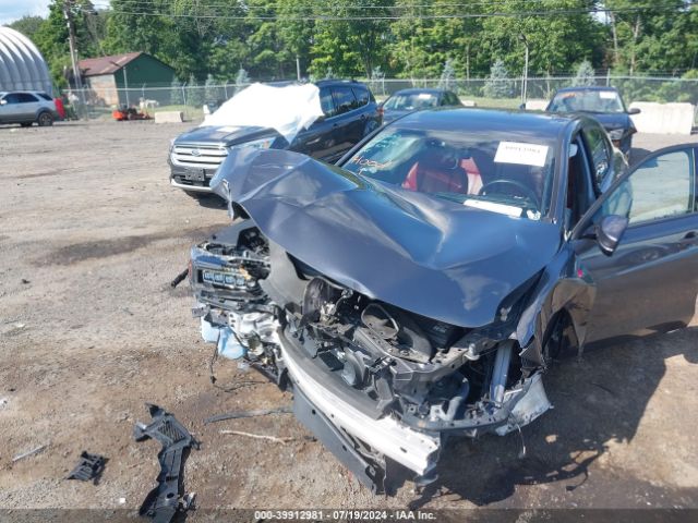 Photo 5 VIN: 19UUB3F60LA002419 - ACURA TLX 