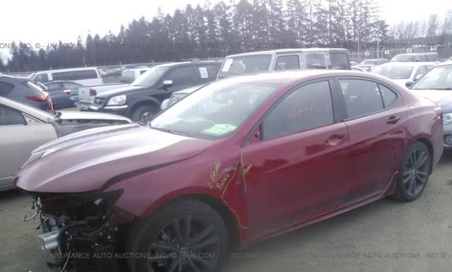 Photo 1 VIN: 19UUB3F63JA002637 - ACURA TLX 