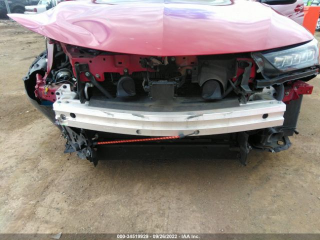 Photo 5 VIN: 19UUB3F63KA004521 - ACURA TLX 