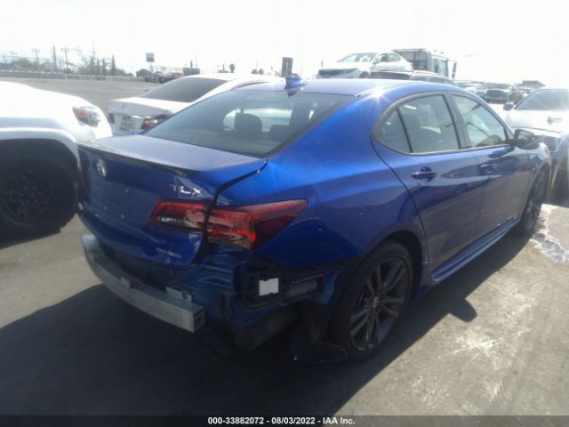 Photo 3 VIN: 19UUB3F63LA002303 - ACURA TLX 