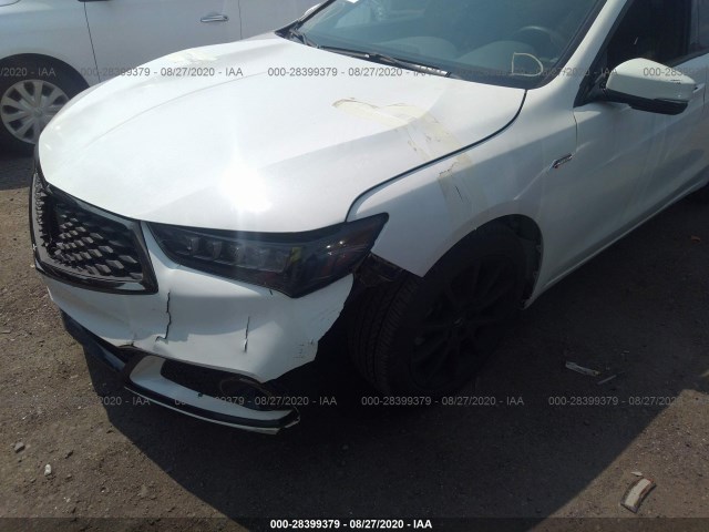 Photo 5 VIN: 19UUB3F64JA004977 - ACURA TLX 