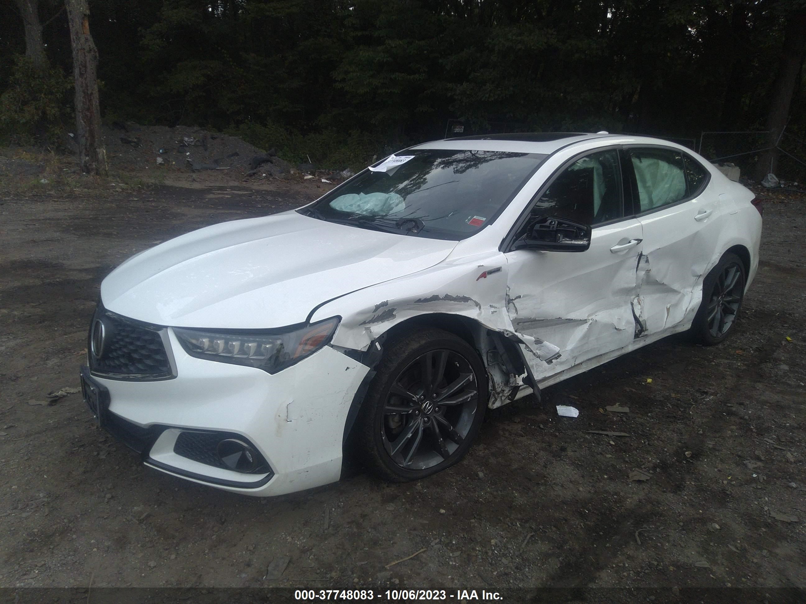 Photo 5 VIN: 19UUB3F65JA005166 - ACURA TLX 