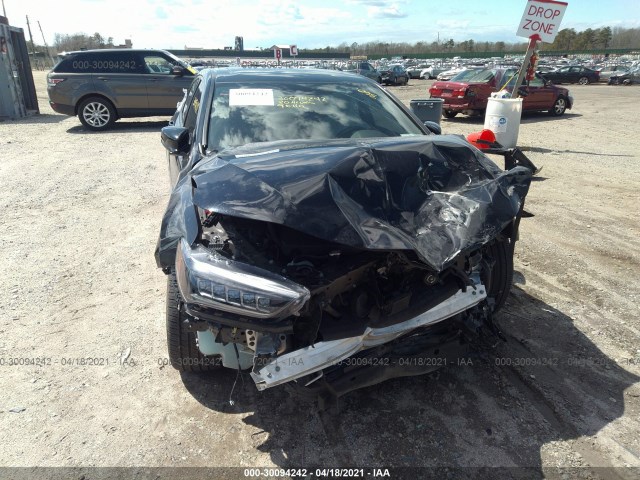 Photo 5 VIN: 19UUB3F65LA000987 - ACURA TLX 