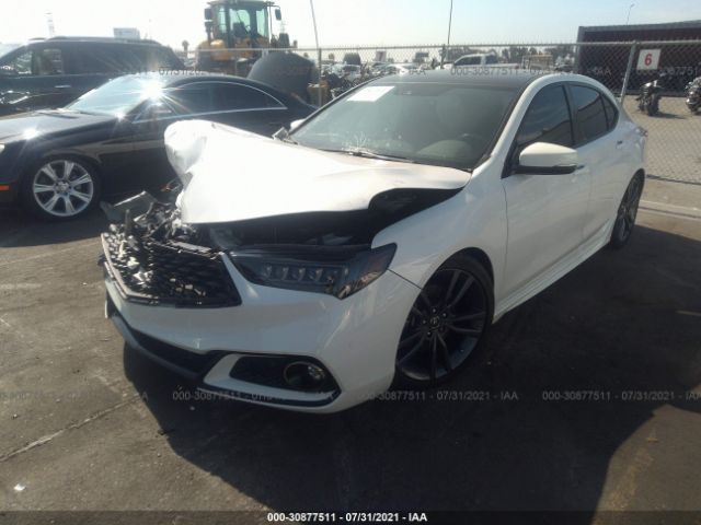 Photo 1 VIN: 19UUB3F68JA006134 - ACURA TLX 