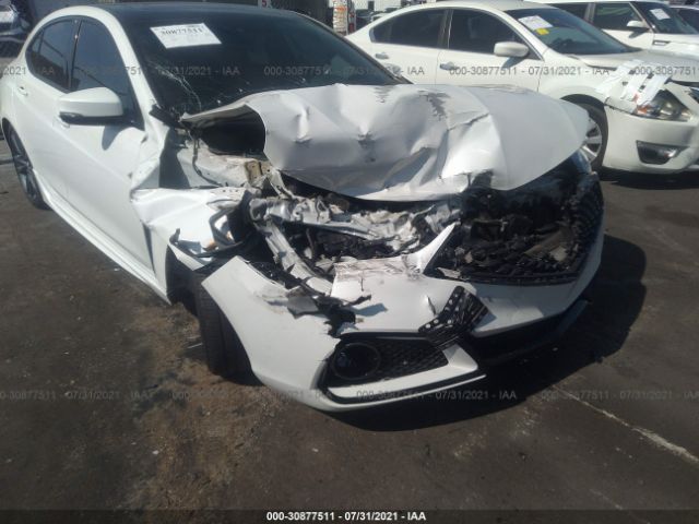 Photo 5 VIN: 19UUB3F68JA006134 - ACURA TLX 