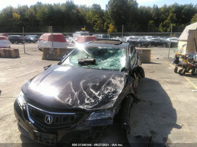 Photo 5 VIN: 19UUB3F72FA010700 - ACURA TLX 