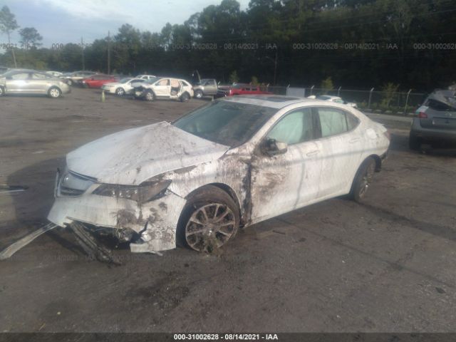 Photo 1 VIN: 19UUB3F72HA001515 - ACURA TLX 