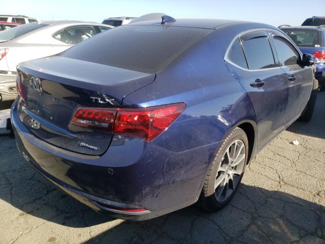 Photo 3 VIN: 19UUB3F72HA003569 - ACURA TLX ADVANC 